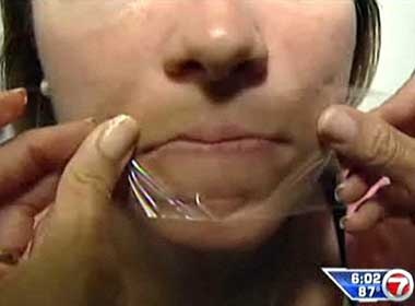 Dung bang dinh bit mieng hoc sinh vi noi chuyen hinh anh