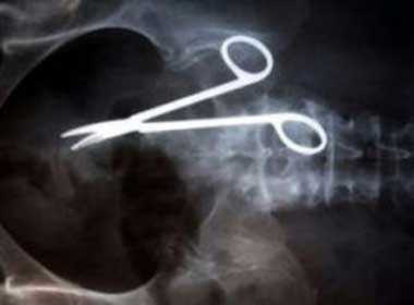 Bo quen keo 3 nam trong bung benh nhan hinh anh