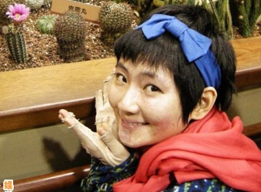 Selina lo mat sau 4 thang xuat vien hinh anh