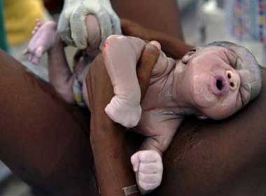 Phong su anh doat giai Pulitzer 2011 lam rung dong long nguoi hinh anh