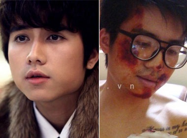 Manh Quan 'Nhat ky Vang Anh' gap tai nan hinh anh