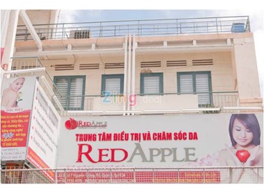 Xoa tan noi lo ve mun cung Red Apple hinh anh
