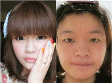 Khac phuc nhuoc diem mat to, mat nho hinh anh