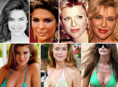 Nhung ngoi sao hoi han vi tung 'dao keo' hinh anh