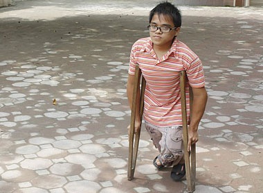 Cau 'hoa si ti hon' den truong bang doi chan thuy tinh hinh anh