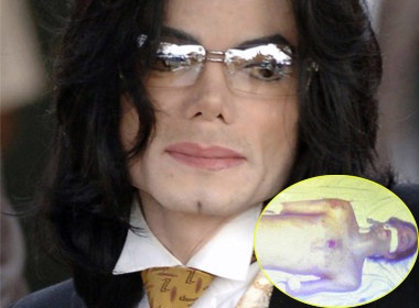 Them anh thi the gay soc cua Michael Jackson hinh anh