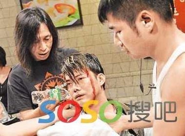 Sao Hoa ngu dap mat vi tai nan khi dong phim hinh anh