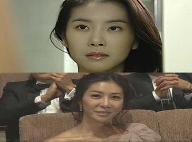 My nhan Han bien chung sau phau thuat tham my hinh anh