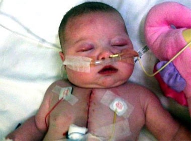 Be gai duoc cuu song nho thuoc viagra hinh anh