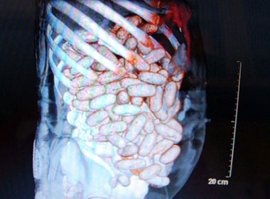 Giau 2 kg cocaine trong bung de buon lau hinh anh