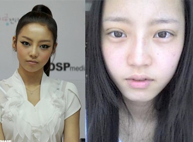 Mat Goo Hara sung hup sau phau thuat tham my hinh anh