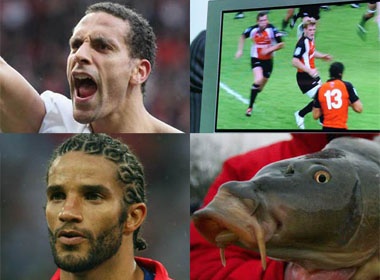 Nhung chan thuong ky quac nhat gioi cau thu hinh anh