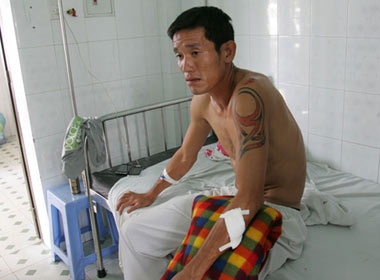 Trung ve Chi Cong bi chem trong thuong hinh anh