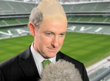Mai toc kho do cua HLV Ireland hinh anh