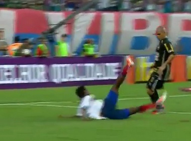 Chan thuong khoi hai cua cau thu Brazil hinh anh