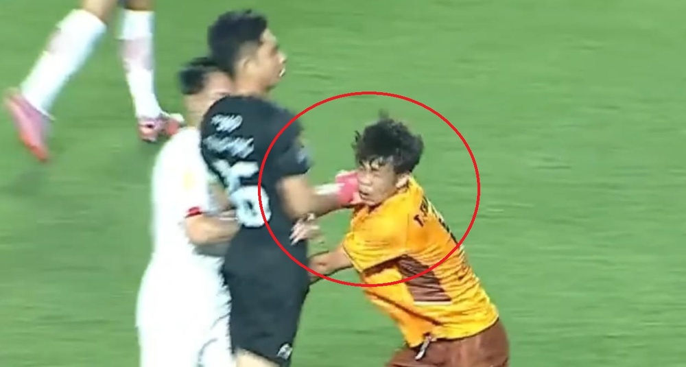 Cau thu HAGL bi dam vao mat hinh anh