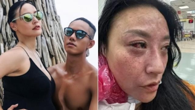 Dien vien Tam Van bi chong kem 16 tuoi bao hanh hinh anh