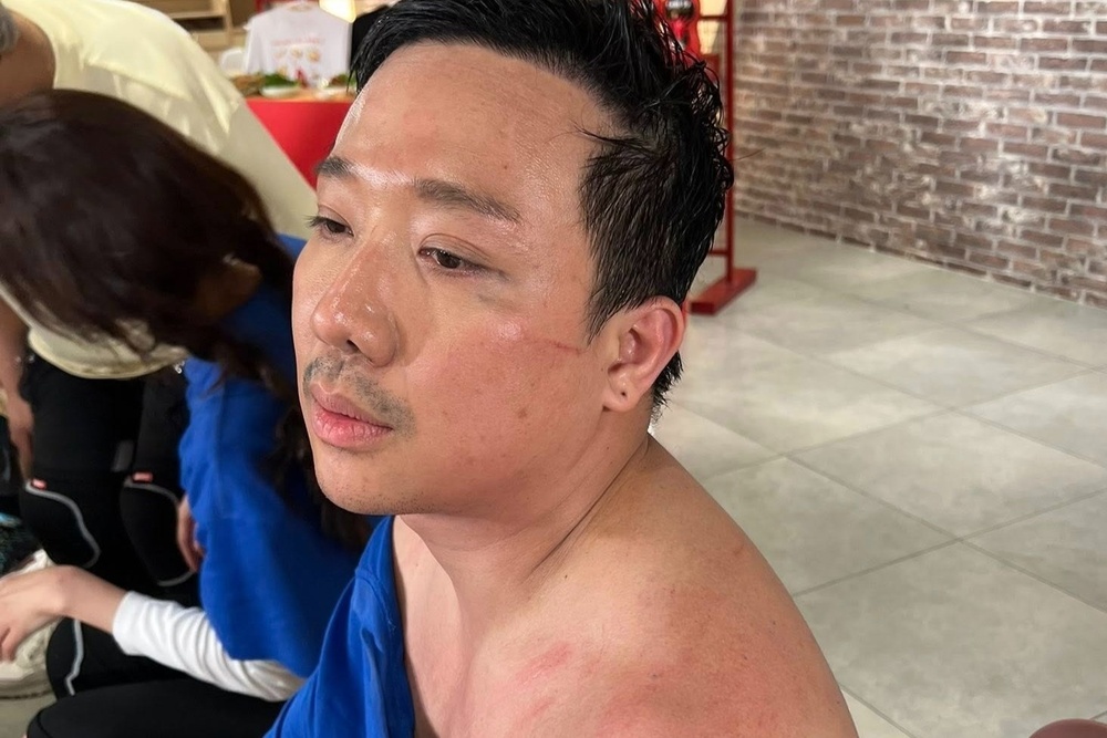 Phim co Tran Thanh bi danh bai hinh anh