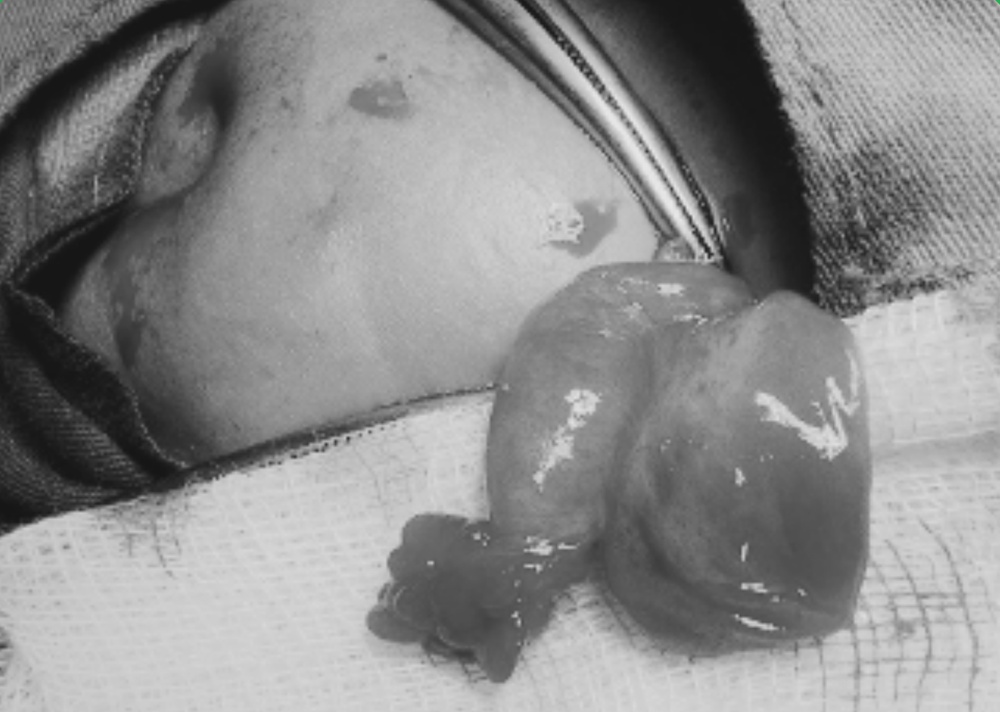 Mot truong hop canh bao tu be gai 11 thang tuoi hinh anh