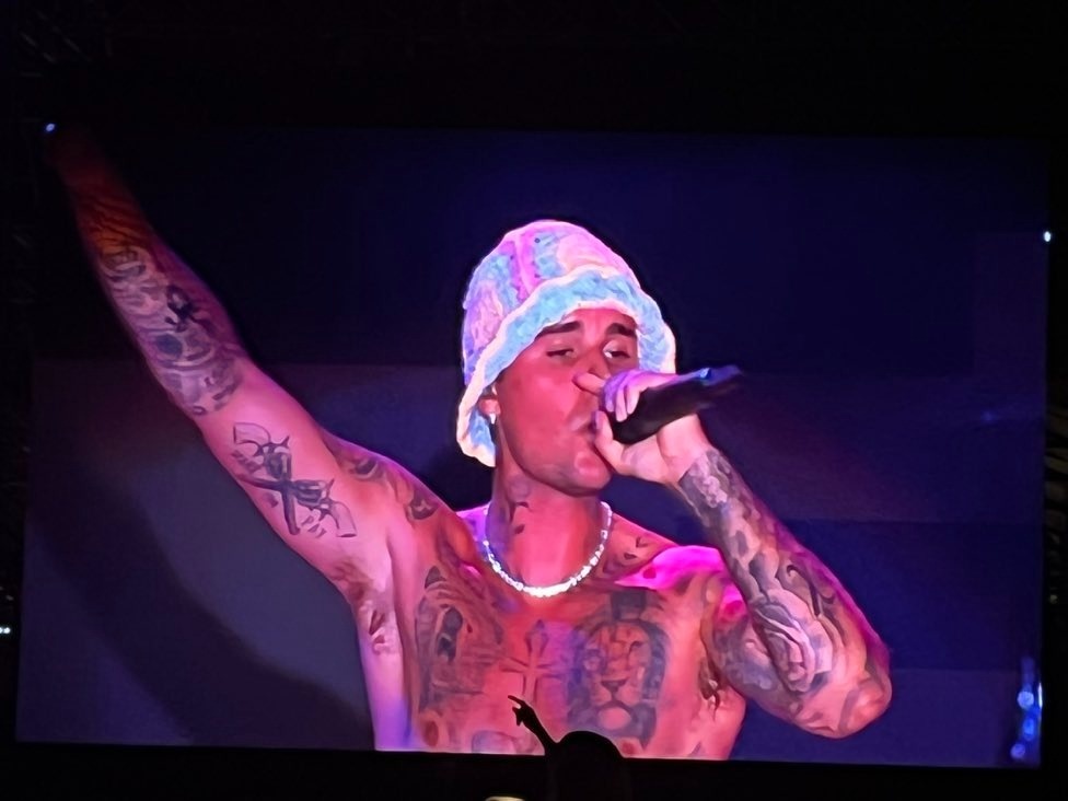 Justin Bieber sau khi liet co mat anh 1