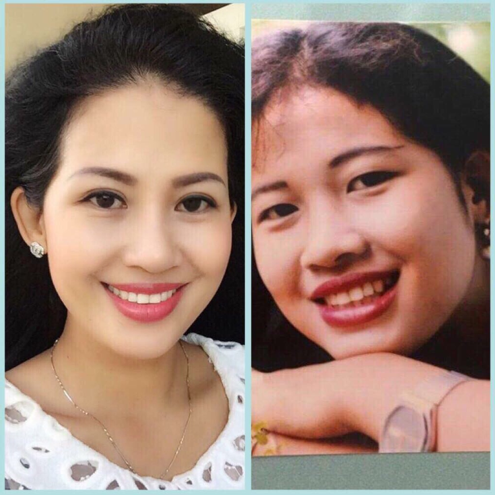 Tham my vien Phuong Dung anh 2