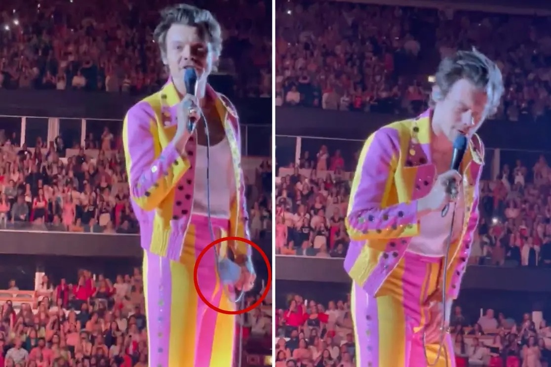 Harry Styles bi tan cong anh 1