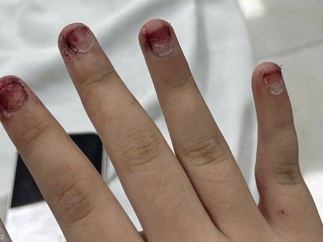 Hanh hung da man,  Bat quy anh 2