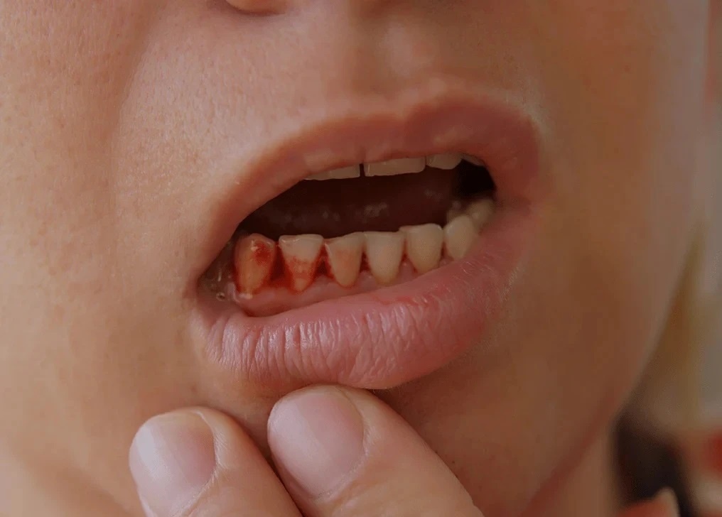 Dau hieu duong huyet cao anh 7