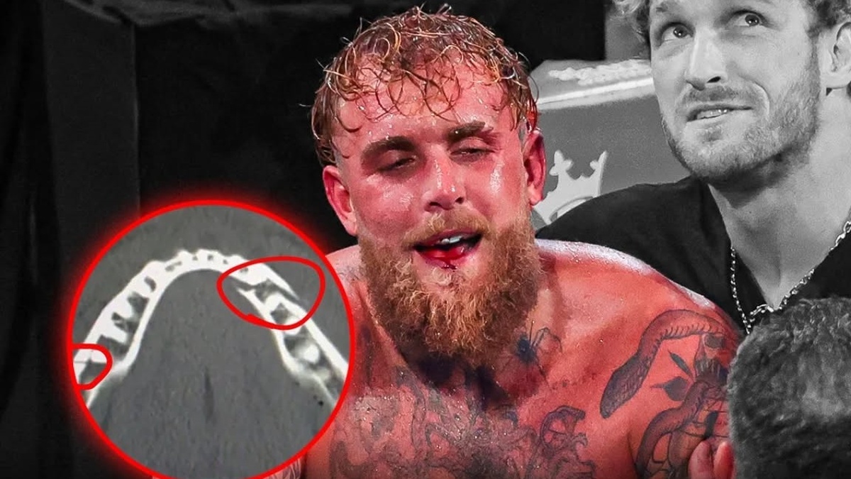 Jake Paul gãy xương hàm, bị cấm thượng đài | Znews.vn