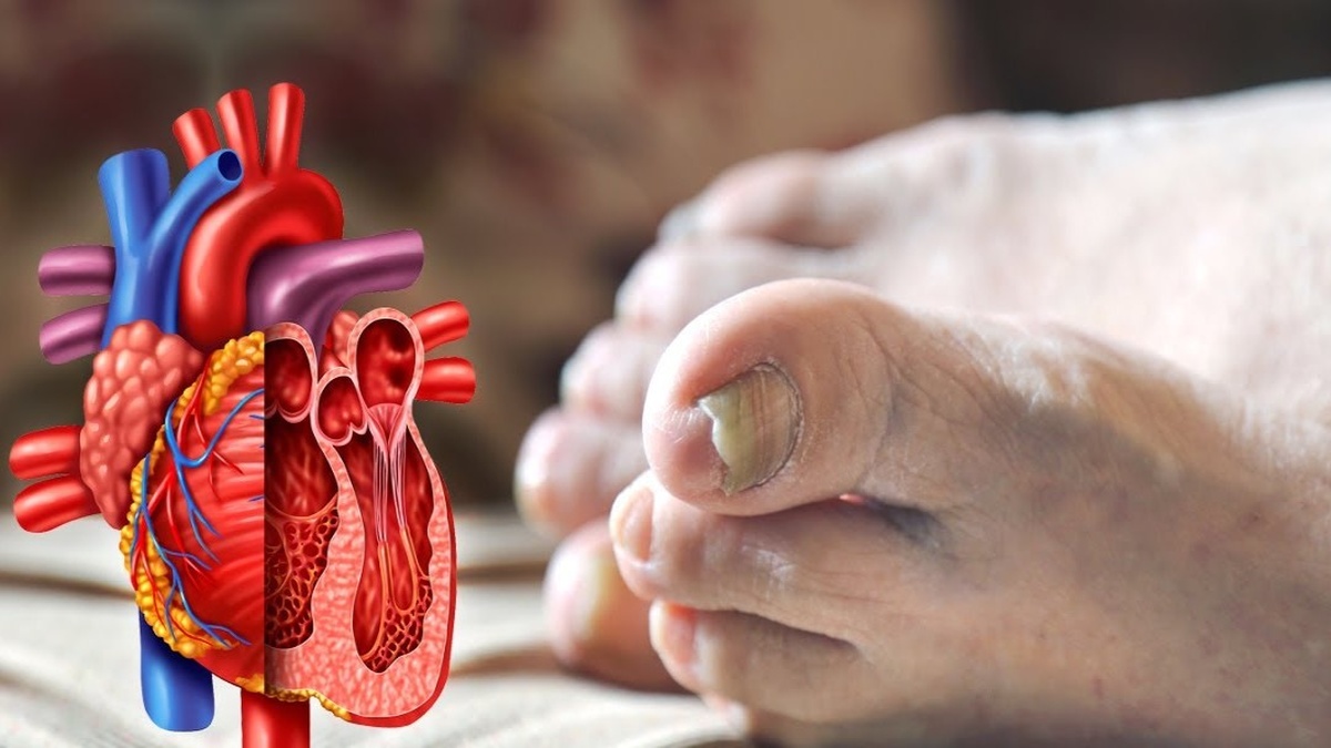 Tay, chân lạnh cảnh báo sức khỏe gặp vấn đề gì? | Znews.vn