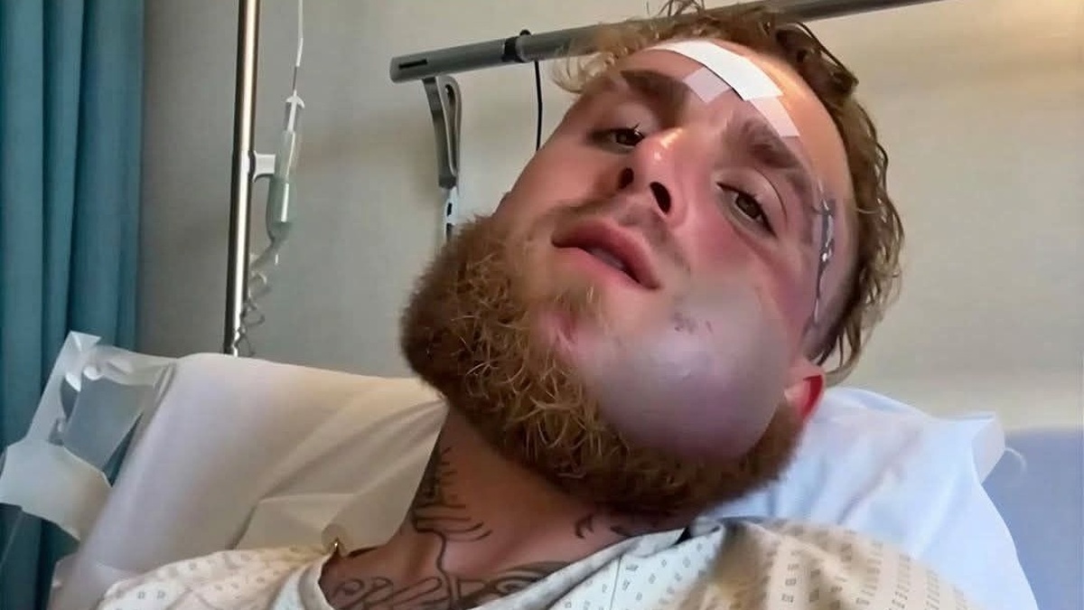 Mặt Jake Paul biến dạng | Znews.vn