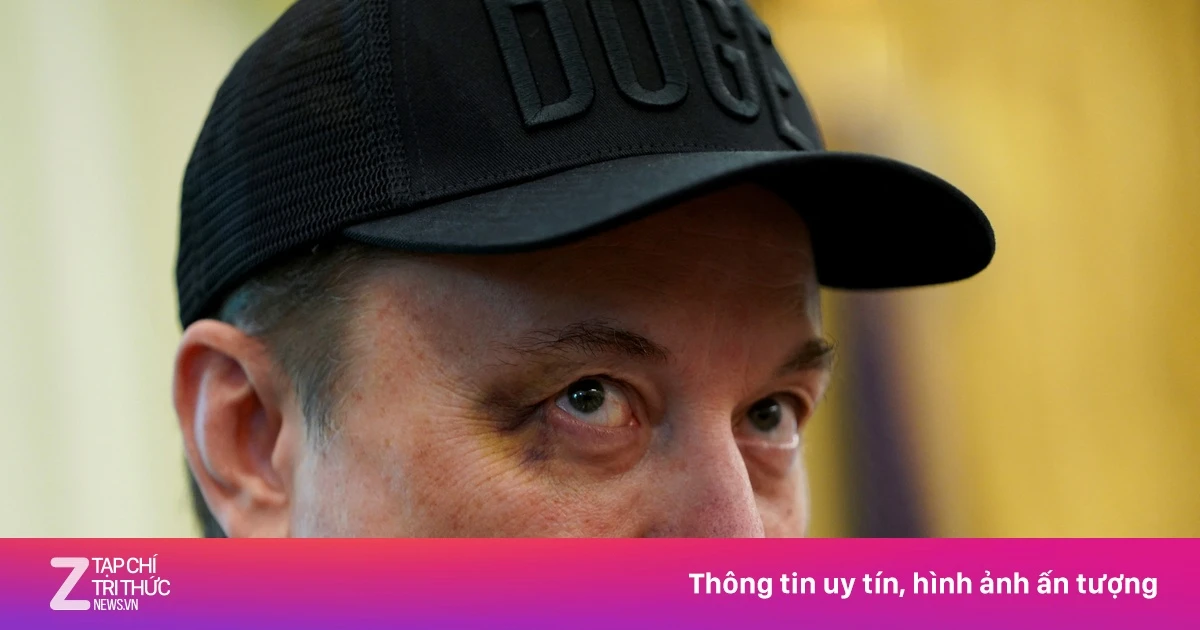 Elon Musk 'rời' Nhà Trắng với vết bầm tím trên mắt