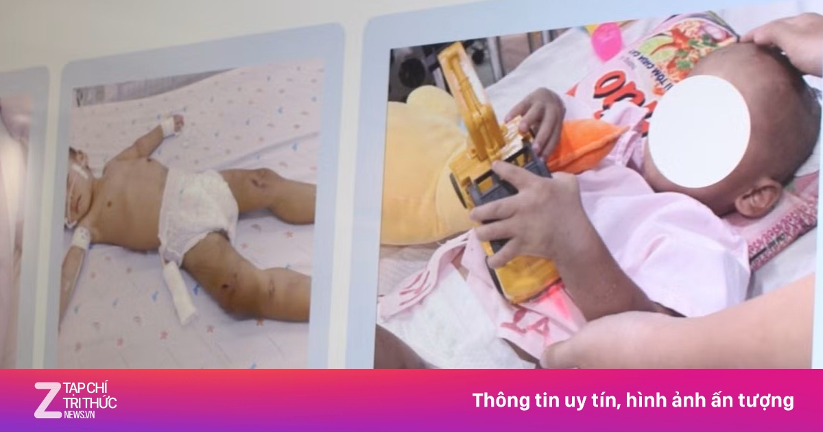 Bé trai 2 tuổi bị bạo hành vẫn khóc gọi mẹ mỗi đêm
