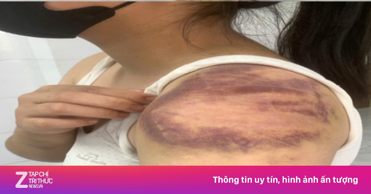 Bắc Ninh tạm giữ người đàn ông bạo hành vợ mang thai và con gái 13 tuổi