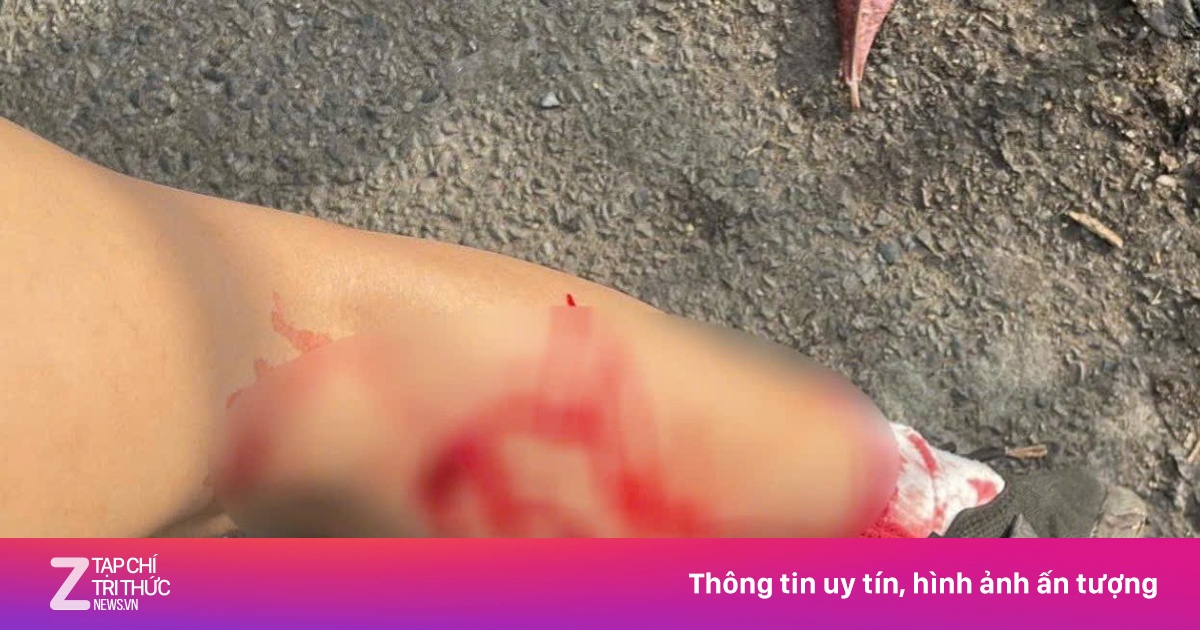 Khỉ hoang cắn người ở Vũng Tàu