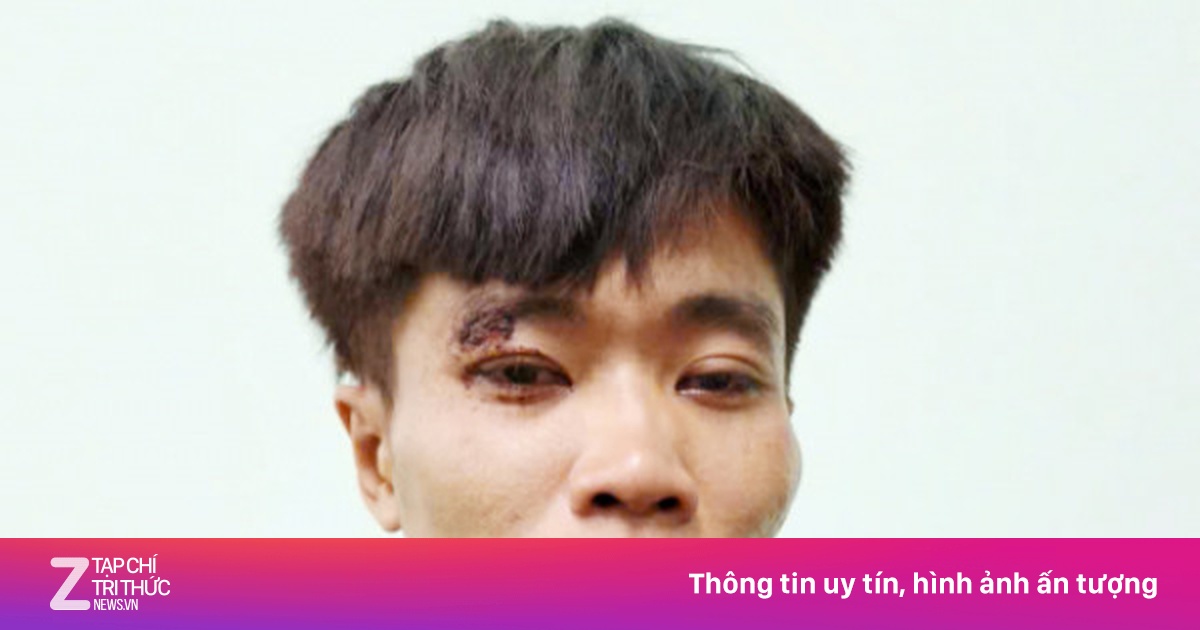 Cảnh Sát An Giang Truy Bắt Thành Công Đối Tượng Trộm Ôtô Tải Trị Giá 300 Triệu Đồng