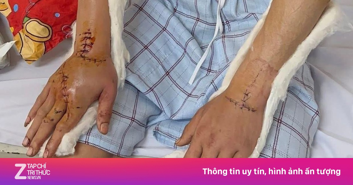 Nạn nhân bị chém về quê ăn Tết xuất viện, tài xế taxi tốt bụng hỗ trợ miễn phí