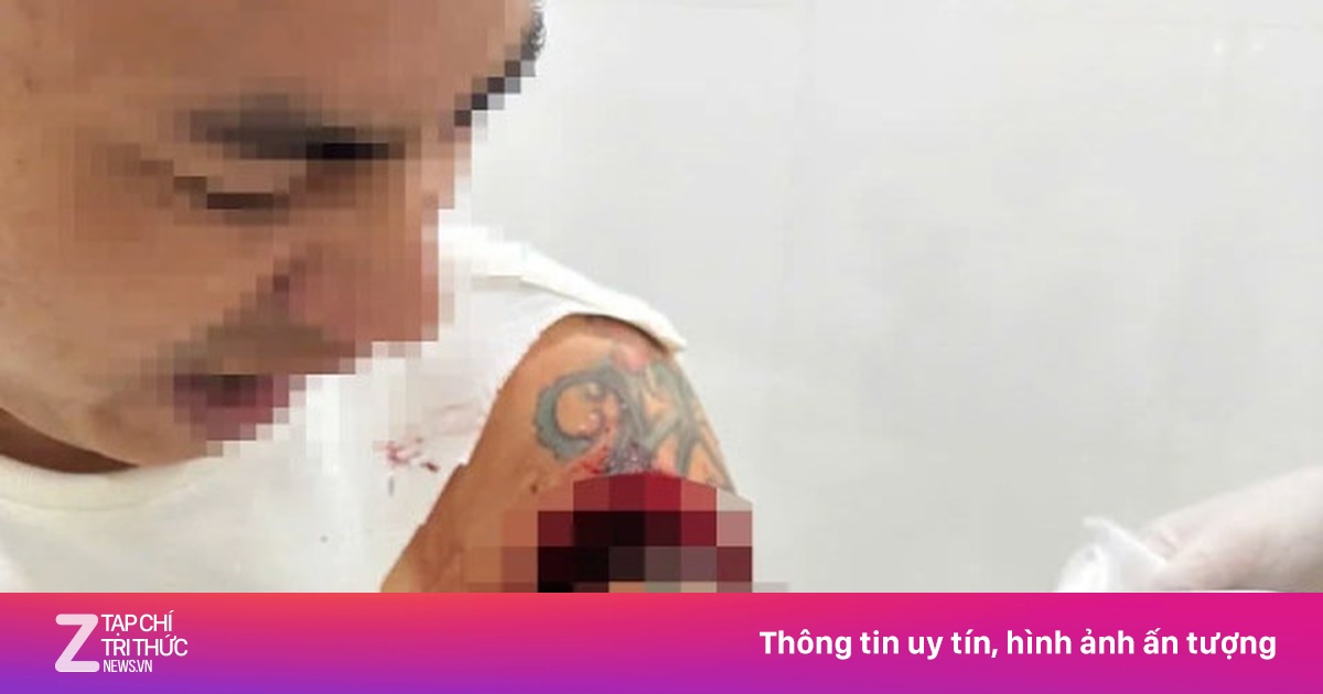 Người đàn ông bị chém trọng thương khi đang ngồi uống cà phê