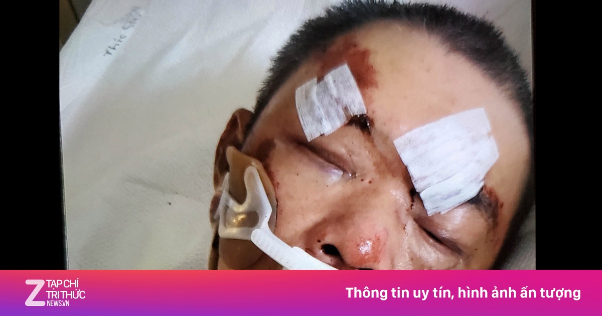 zingnews.vn
