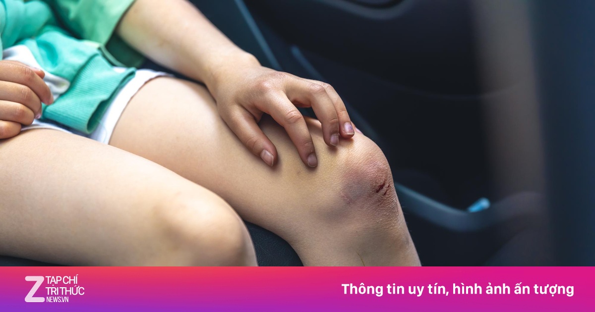 Bàng hoàng vì mắc ung thư đại trực tràng khi mới 30 tuổi