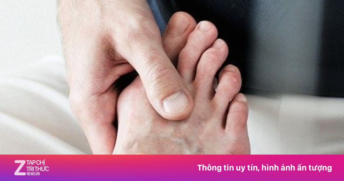 Bệnh gout có di truyền không?