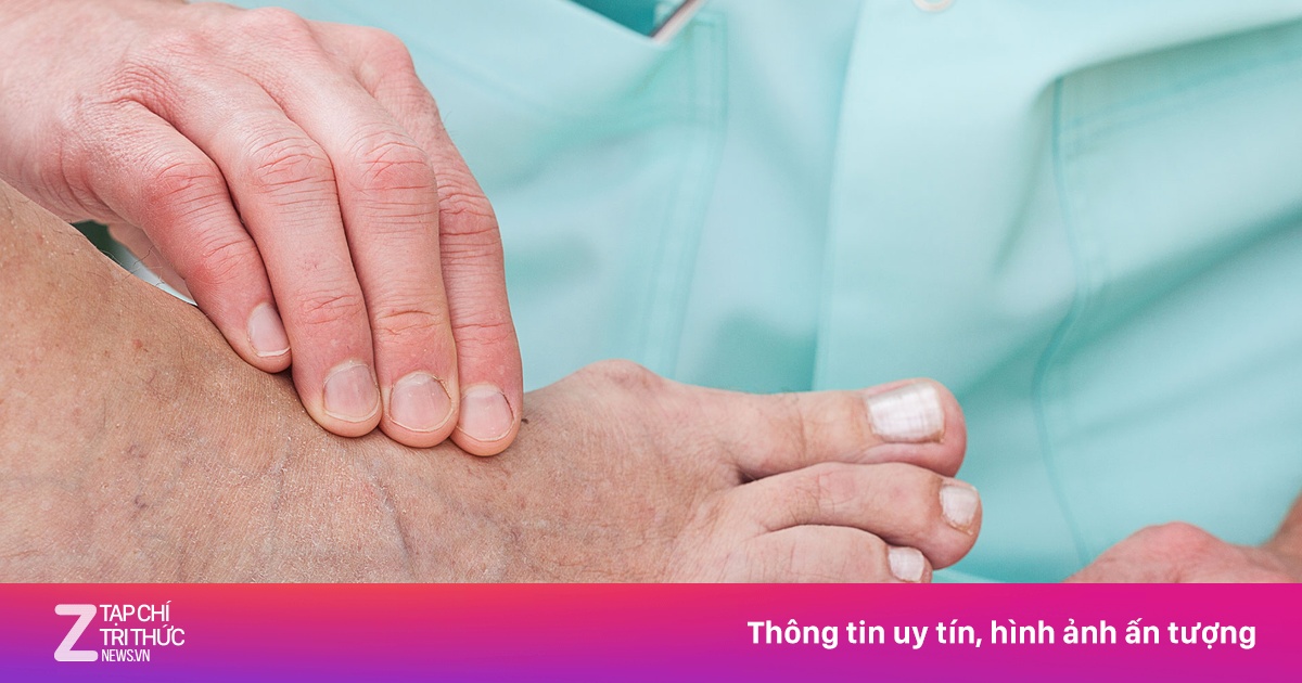 Người mắc tiểu đường, suy thận, gout nên ăn uống như thế nào?