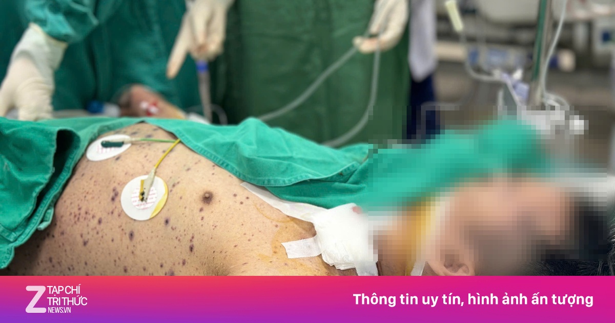 Căn bệnh quen thuộc khiến 2 người khỏe mạnh nguy kịch sau vài ngày