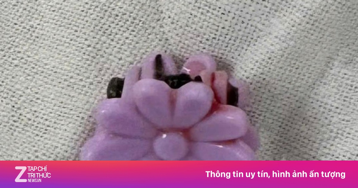 Tưởng bệnh tiêu hóa, bé gái bất ngờ được chẩn đoán có dị vật vùng kín