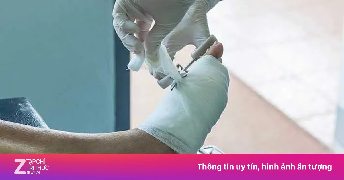 Một sai lầm nhỏ khiến cụ ông nhập viện với nguy cơ cắt cụt chân