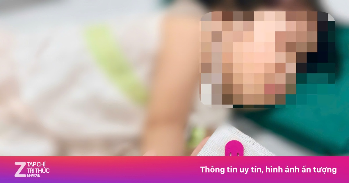 Bé 21 tháng tuổi phải nhập viện vì kẹp tóc nằm trong dạ dày