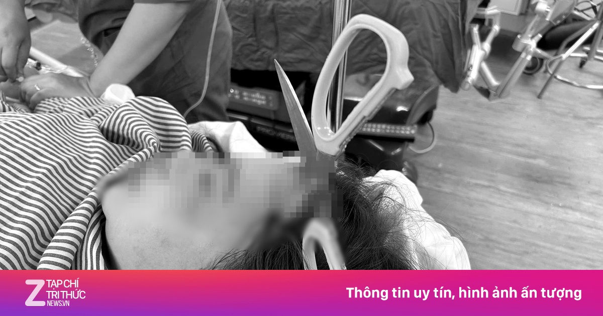 Cứu cô gái bị lưỡi kéo đâm xuyên sọ