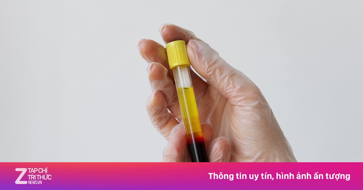Những dấu hiệu mơ hồ nhưng nguy hiểm của mỡ máu cao