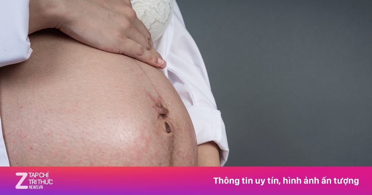 Căn bệnh quen thuộc khiến bà mẹ trẻ sinh non ở tuần 31