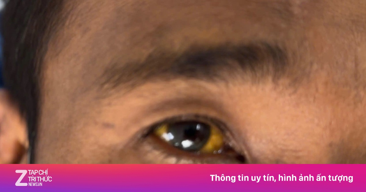 Gan tổn thương nặng chỉ vì một quyết định sai lầm